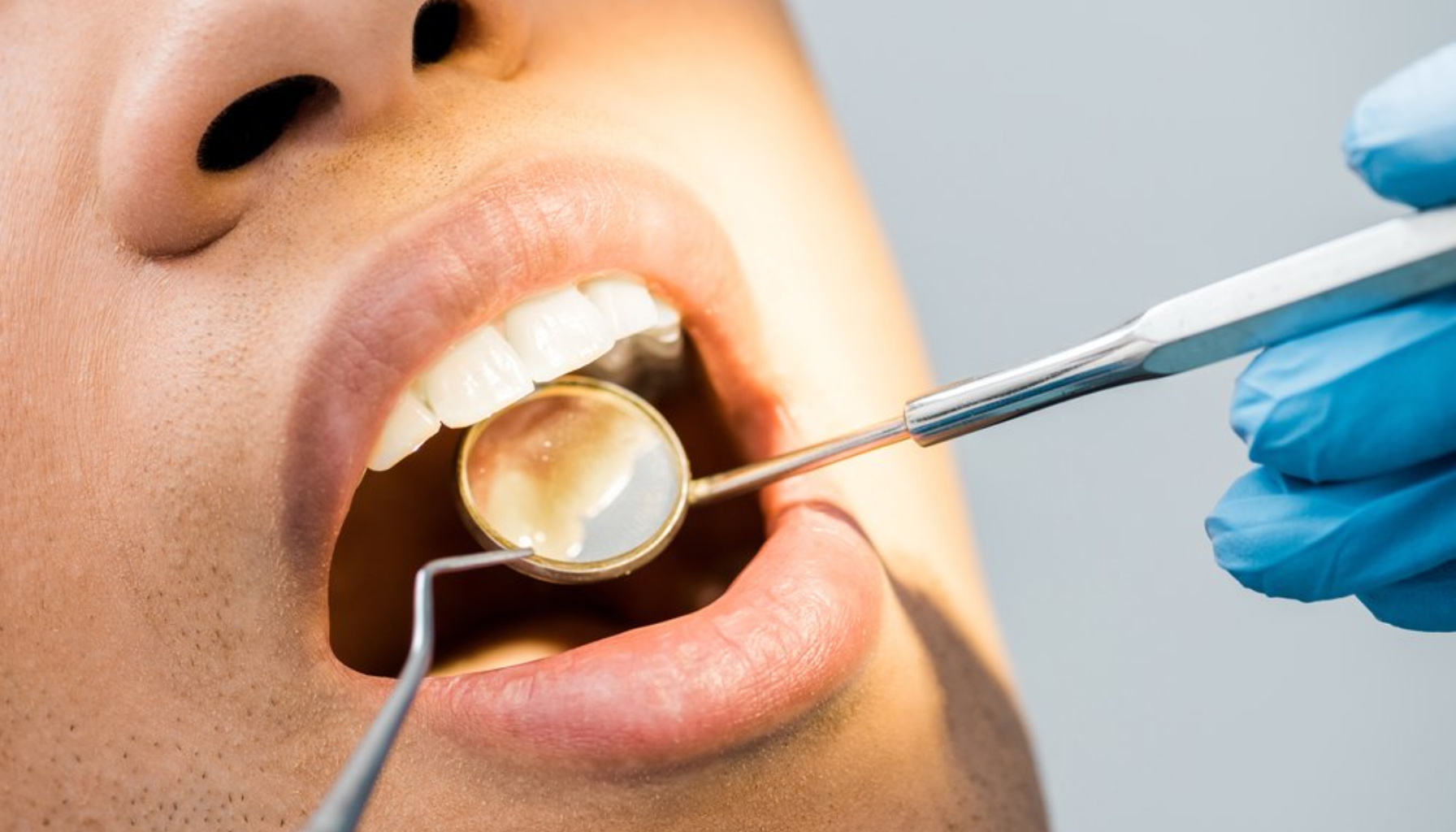 Sure Oppstøt og Tennene Dine: Den Usynlige Fienden i Magen 11 Tannlege inspiserer tennene til pasient med speil og utforsker verktøy, med blå hanske i fokus på detaljert undersøkelse.